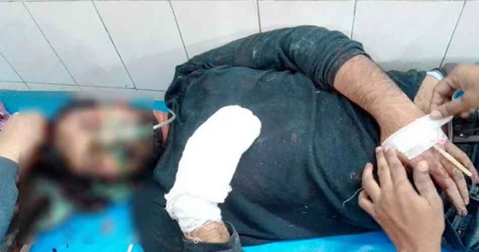 রায়পুরায় আসামি ধরতে গিয়ে হামলায় র‌্যাব সদস্যের তিন আঙুল বিচ্ছিন্ন